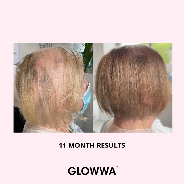 GLOWWA hair food