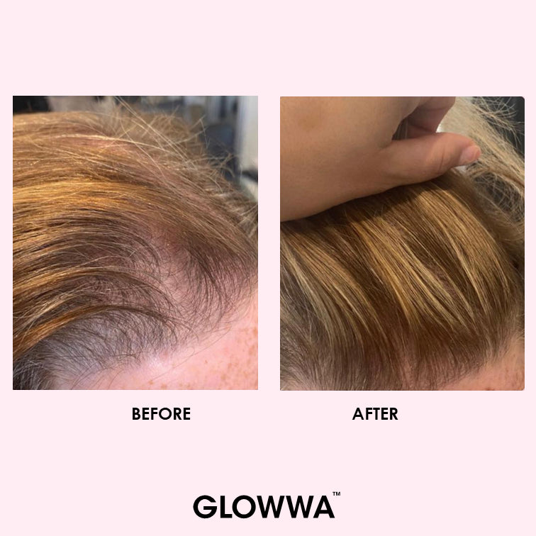 GLOWWA hair food